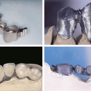 Esempi-di-saldatura-dentale-2