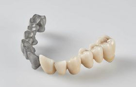 aplicacion-fabricaion-aditiva-3d-dentadura