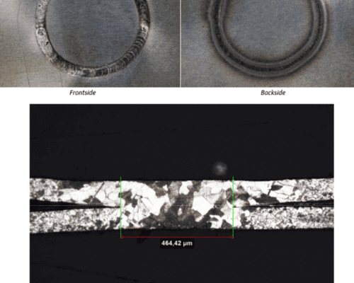 Las imágenes muestran una vista frontal y posterior de un objeto circular y un examen macro con una medida de 464,42 µm, revelando su estructura interna.